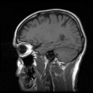 370098_mri_head_scan.jpg